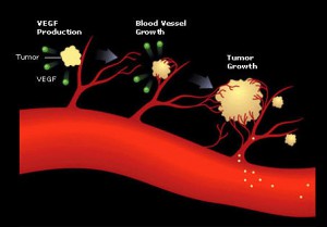 angiogenesis-oncology-6590365-454-3171