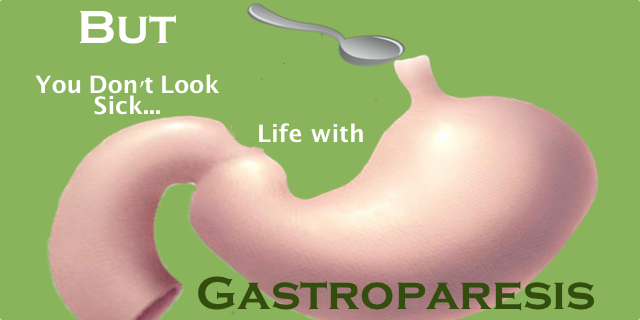 Guest Post:  Gastroparesis Another “But You Don’t Look Sick” Disease