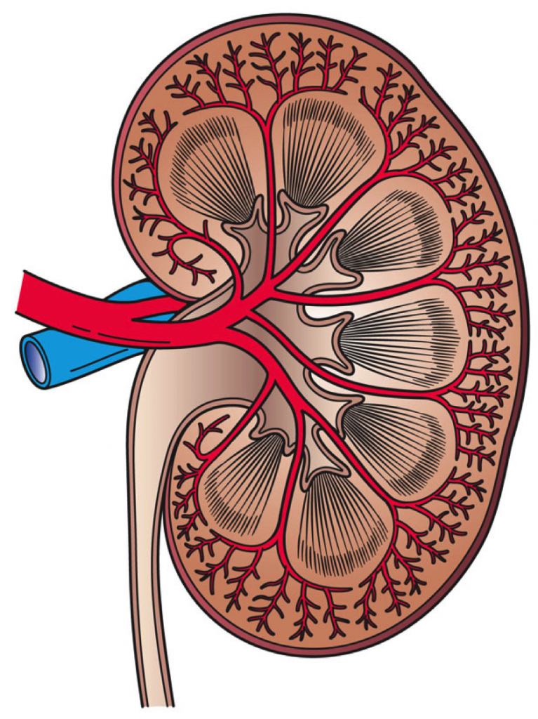 kidney-stones-and-the-risk-of-heart-attack-and-stroke