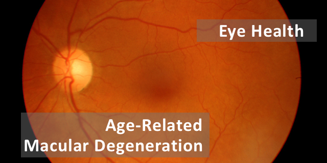 Age-Related Macular Degeneration Awareness Month