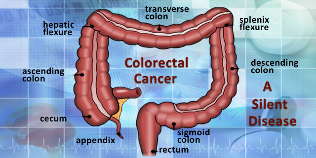 Colorectal Cancer: A “Silent Disease”
