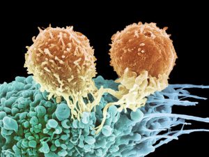 CAR-T cells
