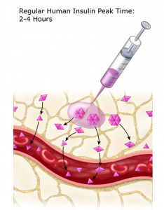 insulin replacement therapy