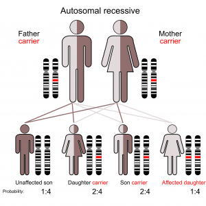 usher syndrome