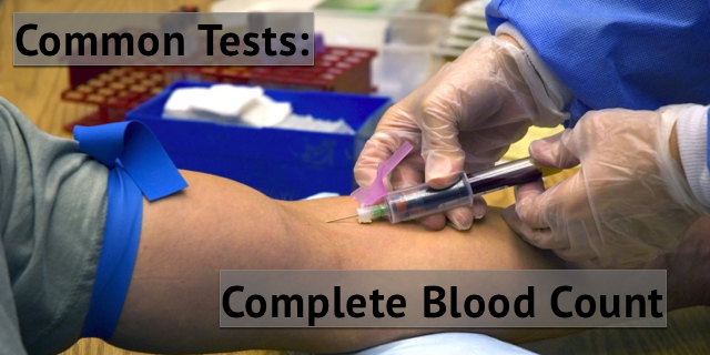 Common Tests Explained: Complete Blood Count or CBC Infographic