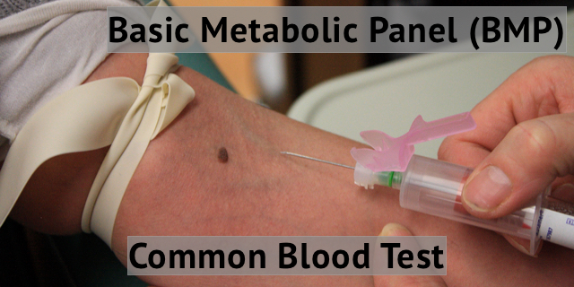 Common Tests Explained: Basic Metabolic Panel or BMP