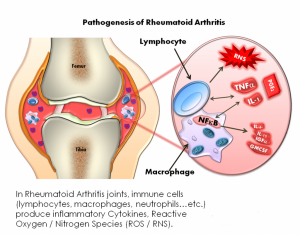 rheumatoid disease