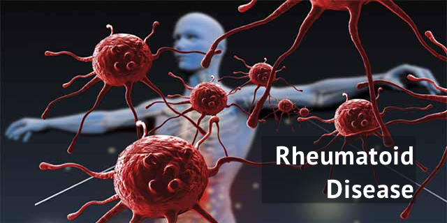 Staying Up-To-Date on Rheumatoid Disease