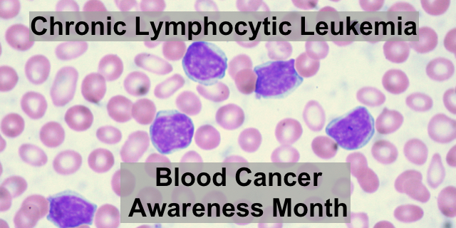 Blood Cancer Awareness Month: CLL
