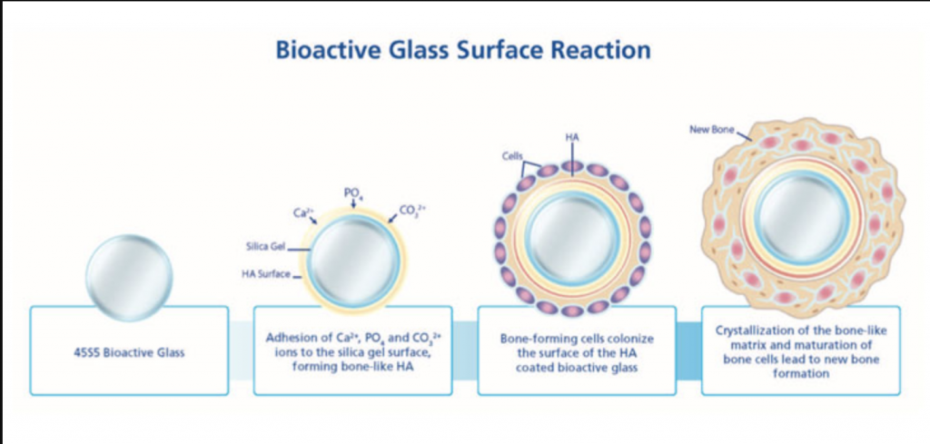 Bioactive glass hot sale