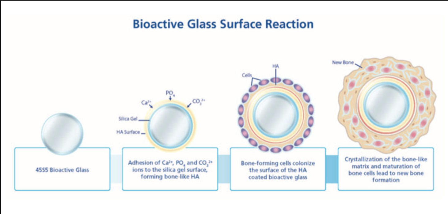 What Is Bioactive Glass? - Medivizor