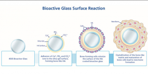 What is Bioactive Glass?
