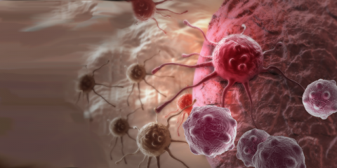 Do lymph node micrometastases and isolated tumor cells influence survival in breast cancer patients?