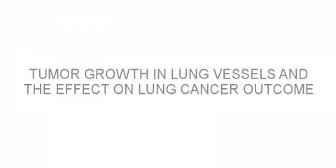 Tumor growth in lung vessels and the effect on lung cancer outcome