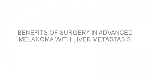 Benefits of surgery in advanced melanoma with liver metastasis