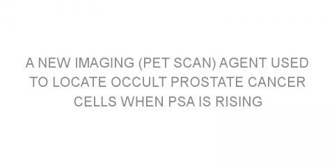 A new imaging (PET scan) agent used to locate occult prostate cancer cells when PSA is rising