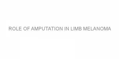 Role of amputation in limb melanoma