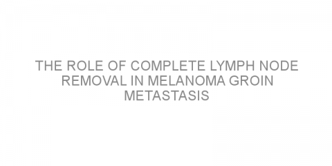 The role of complete lymph node removal in melanoma groin metastasis