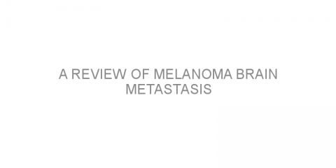 A review of melanoma brain metastasis