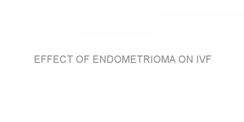Effect of endometrioma on IVF