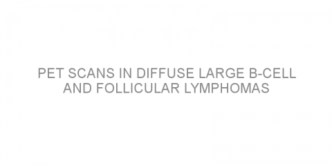 PET scans in diffuse large B-cell and follicular lymphomas