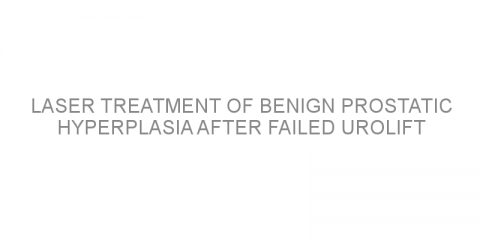 Laser treatment of benign prostatic hyperplasia after failed UroLift