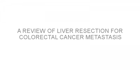 A review of liver resection for colorectal cancer metastasis